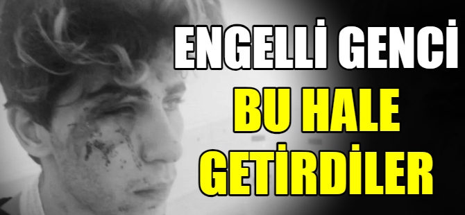 Türk genci darp edildi