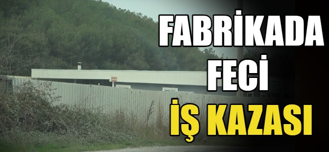 Fabrikada feci kaza