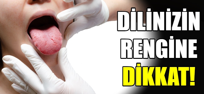 Dilinizin rengine dikkat ettiniz mi?