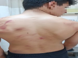 14 yaşındaki çocuğa öldüresiye dayak