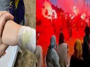 Meşaleli etkinlik çocukları yaktı