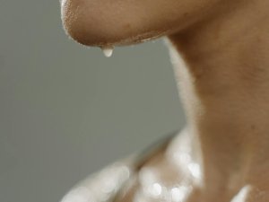 Aşırı terleme sorununa botokslu çözüm!
