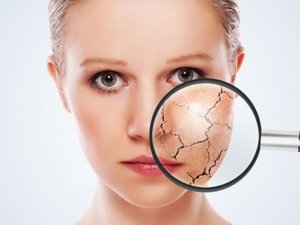 Cildiniz için kışa hazırlık reçetesi