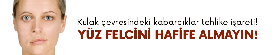 Yüz felci hafife alınmamalı!