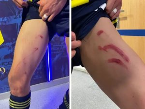 Tekme yiyen Fenerbahçeli yıldızın son hali gündem oldu