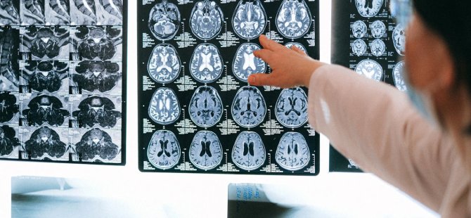 Yıllar sonra 2 vaka! Deli dana geri mi döndü?