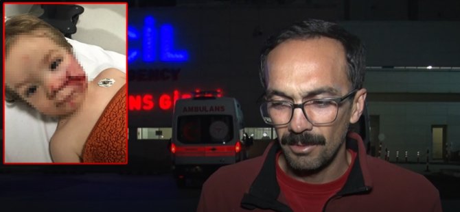 Pitbull dehşeti! Küçük çocuğun yüzü paramparça oldu