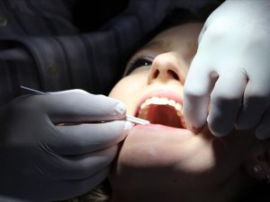 Meclis'e sunulan ücretsiz implant tedavisi için 2 şart var