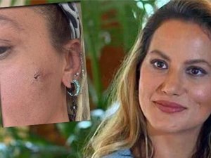 Ünlü isim kocasından şiddet gördüğünü açıkladı!