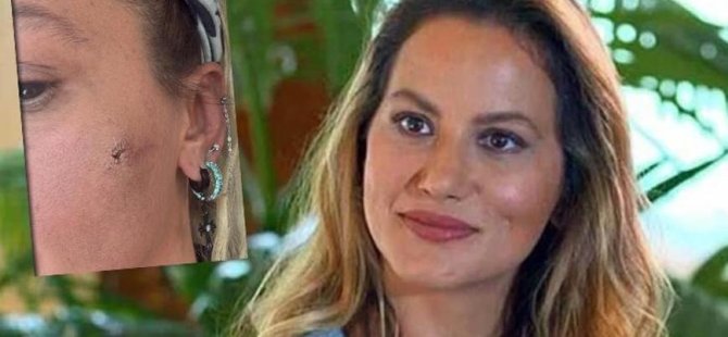 Ünlü isim kocasından şiddet gördüğünü açıkladı!