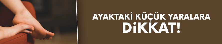Ayaktaki küçük yaralara dikkat!