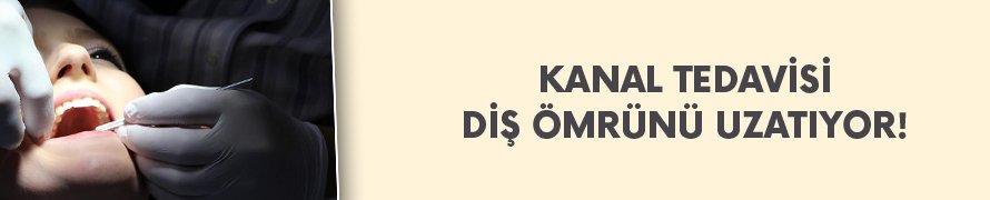 Kanal tedavisi dişin ömrünü uzatıyor!