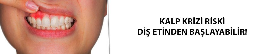 Dikkat! Kalp krizi riski diş etinden başlayabilir