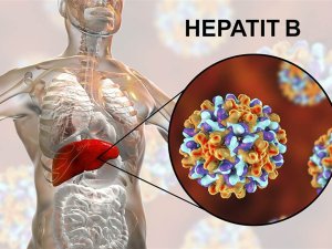 ''Sessiz tehlike hepatiti önlemek mümkün.''