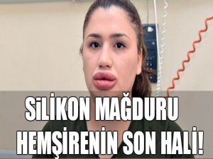 Silikon mağduru hemşirenin son hali