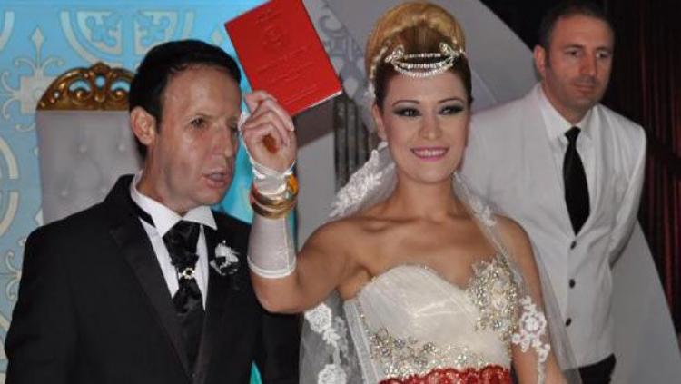 Yüz nakilli Recep Sert sert baba oluyor