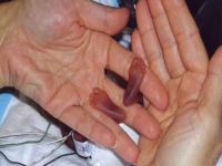 Parmak kız bakın şimdi nasıl?