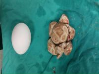 İdrar kesesinden bu çıktı