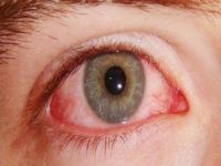 Göz sağlığı hakkında 8 doğru bilgi