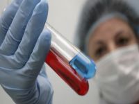 Rusya'da her yıl AIDS'li hasta sayısı 10 bin artıyor