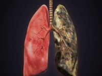 Akciğer kanseri kaderiniz olmasın!