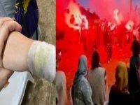 Meşaleli etkinlik çocukları yaktı