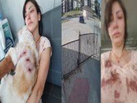 Başıboş köpeklerin saldırısına uğradı