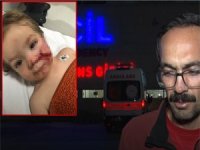 Pitbull dehşeti! Küçük çocuğun yüzü paramparça oldu