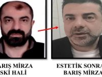 Estetikle kimlik değiştirdi, kardeşi gibi yaşadı... Firari katil Türkiye'de yakalandı