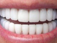 Diş İmplantları U.Üniversitesi'nde araştırılacak