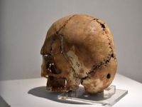 İşte 10 bin yıl önce ilk beyin ameliyatı!